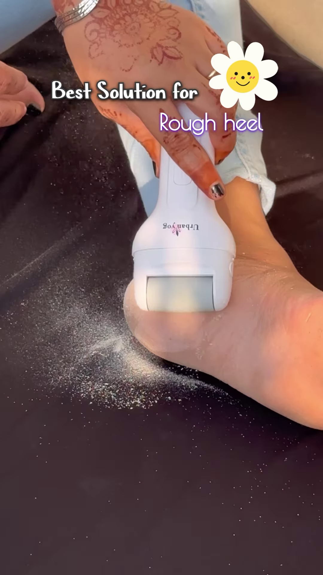 Electric Foot Callus Remover with Roller Head for Smooth Feet - Image 3